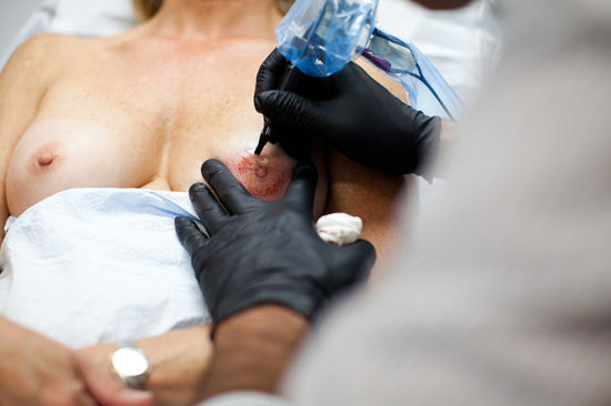 为乳腺癌康复者绘制纹身 为乳腺癌康复者绘制纹身
