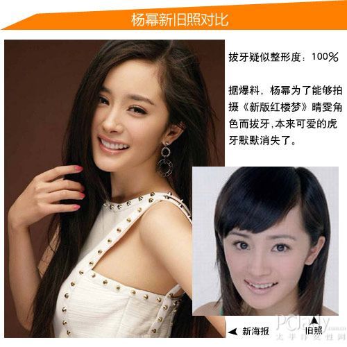 杨幂疑似整形位置:拔牙