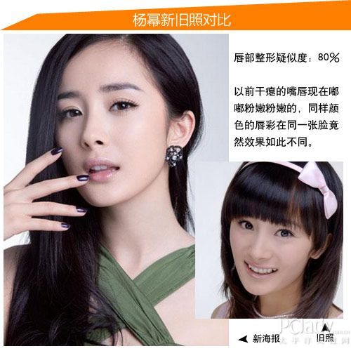 杨幂疑似整形位置:唇部