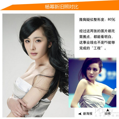 杨幂疑似整形位置:隆胸
