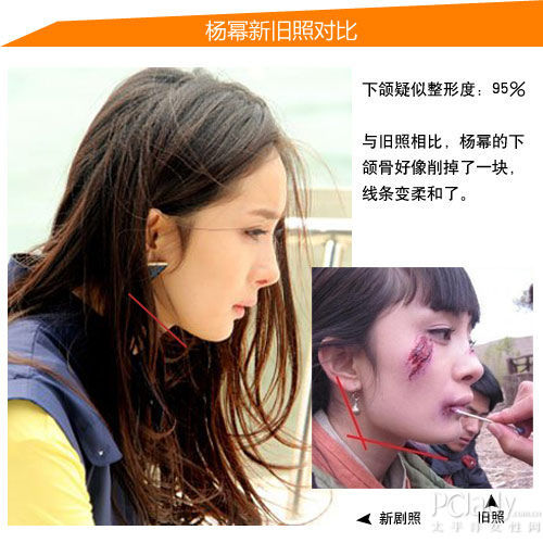 杨幂疑似整形位置:削脸