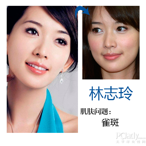 林志玲