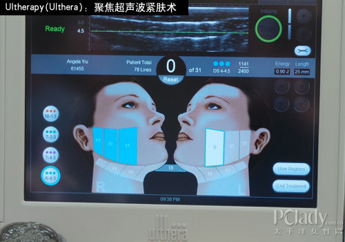 肤质改善篇——Ulthera