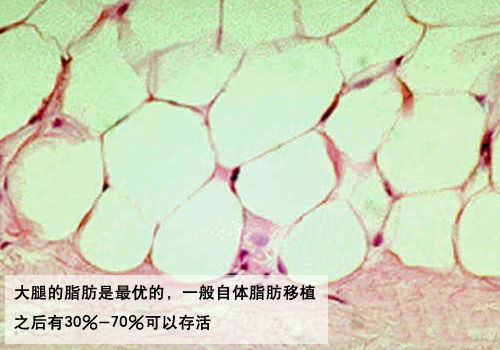 大腿的脂肪是最好的 大腿的脂肪是最好的