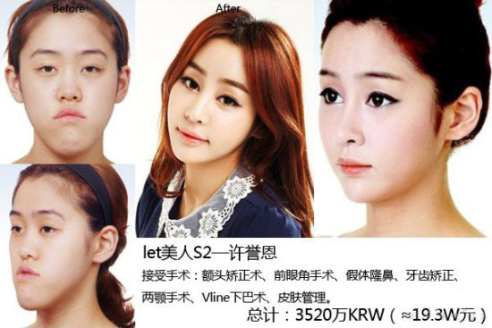 《Let美人》第二季以许誉恩 《Let美人》第二季许誉恩