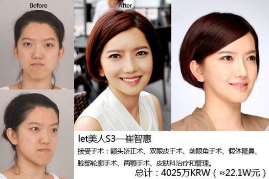 《Let美人》第三季以崔智惠 《Let美人》第三季崔智惠