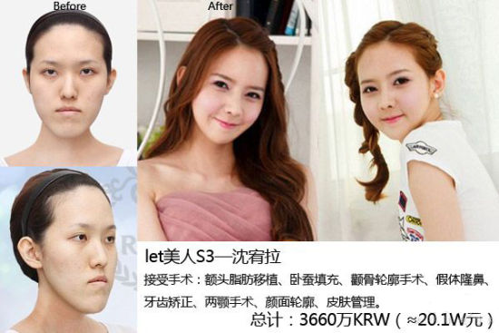 《Let美人》第三季以崔智惠 《Let美人》第三季沈宥拉