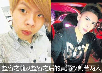 整容之前及整容之后的黄涌权判若两人,就连前女友也认不出他来。 整容之前及整容之后的黄涌权判若两人,就连前女友也认不出他来。