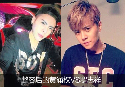 整容后的黄涌权VS罗志祥 整容后的黄涌权VS罗志祥