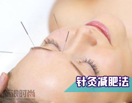 针灸减肥法 针灸减肥法