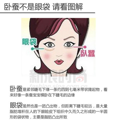 一张图说明卧蚕和眼袋的区别实例说明卧蚕和眼袋的区别