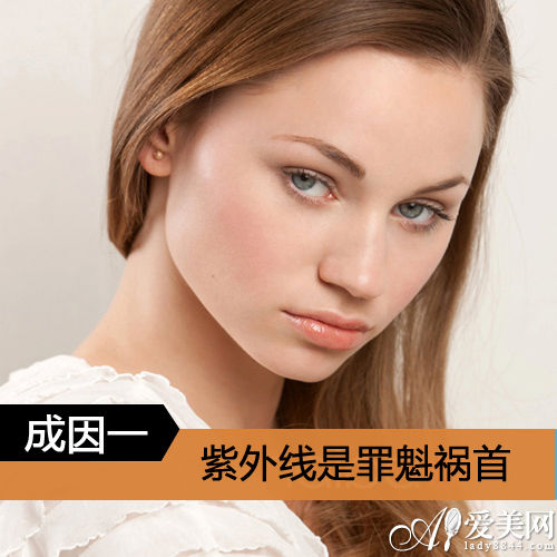 紫外线是色斑形成的罪魁祸首