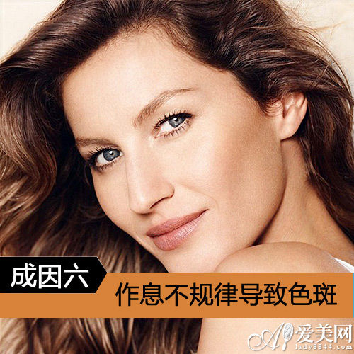 作息不规律导致色斑