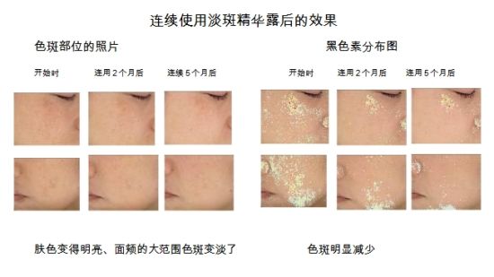 连续使用淡斑精华露后的效果