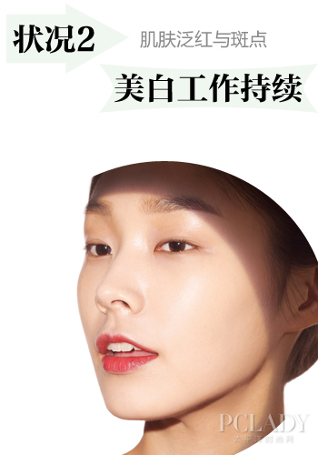 状况2:敏感泛红与斑点肤质,美白工作持续进行中