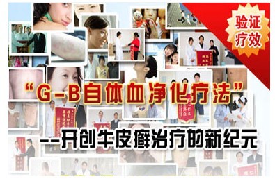 G-B自体血净化疗法 G-B自体血净化疗法