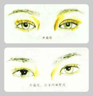 扇形双眼皮 扇形双眼皮