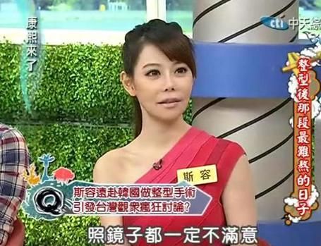 斯容在节目上讲整形经历 斯容在节目上讲整形经历