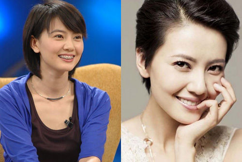 高圆圆也曾是3个月的“牙套妹” 高圆圆也曾是3个月的“牙套妹”