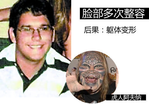 虎男整得满意,却不为社会接受。 虎男整得满意,却不为社会接受。