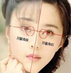 网传范冰冰开眼角对比图