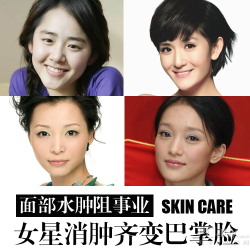 面部水肿阻事业 女星消肿齐变巴掌脸文根英