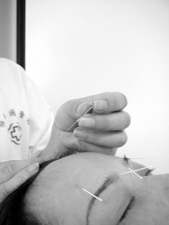 中医养颜驻容术全程见证(组图)(2)