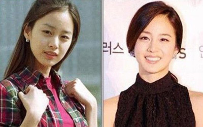 全智贤尹恩惠 谁整容最成功?|整容|尹恩惠|全智贤