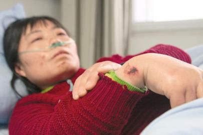 女车主疑环卫女工将宝马车弄脏 将其打伤