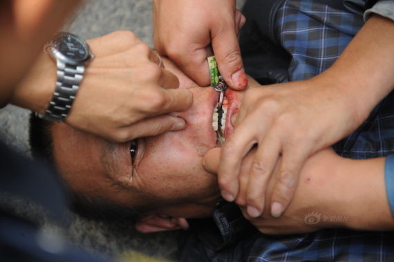 太原街头“黑车”被查 司机拒扣车吞钥匙