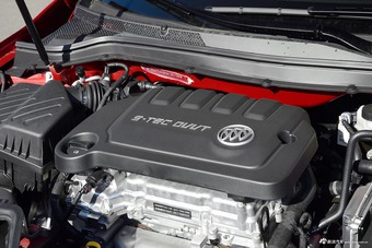 2017款英朗1.5L手动精英型15N