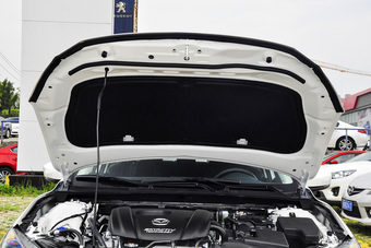 2017款马自达3昂克赛拉 三厢 1.5L 自动舒适型