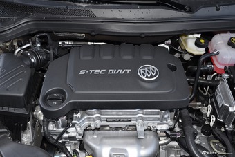 2017款英朗 15N 1.5L自动精英型