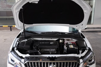 2015款英朗15N自动精英型