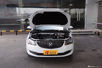 2015款英朗15N自动精英型