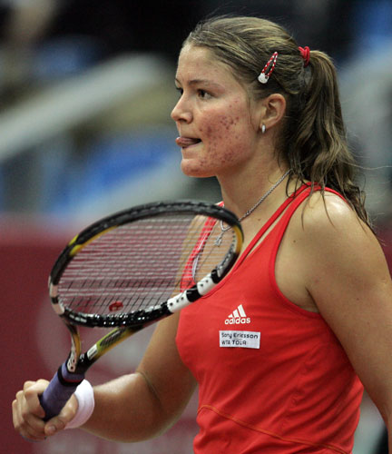 TA克里姆林杯半决赛战况 萨芬娜满脸青春痘_