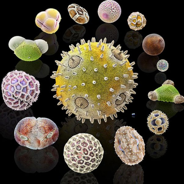 扫描电镜下的花粉粒 柳树花粉犹如黄金荔枝 图 手机新浪网 扫描电镜下的花粉粒 柳树花粉犹如黄金荔枝 图 手机新浪网