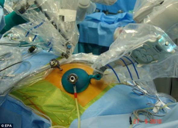 机器人辅助外科手术作业面小，能极大地减少术后并发症