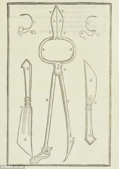该书甚至展示了手术所用的工具