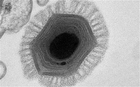 世界最大的病毒