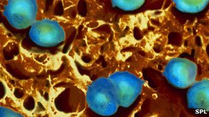 英国境内的淋病患病率今年呈现逐年下降的趋势，但是2010年出现了轻微的回升