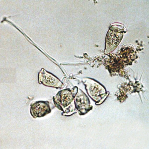 杭师大女生发现一种原生动物新种