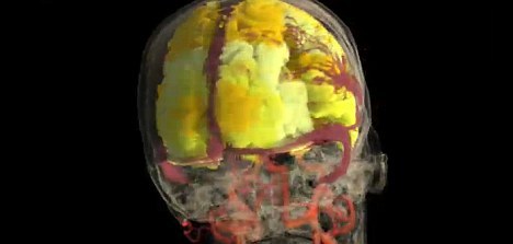 　　在性高潮时，几个所有大脑区域都处于活跃状态。这种活跃从与生殖器有关的感觉皮层开始，而后迅速扩散到整个大脑