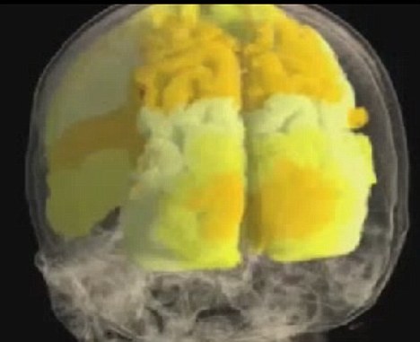 在核磁共振影像中，不同的颜色代表不同的活跃程度，红色最低，黄色和白色最高