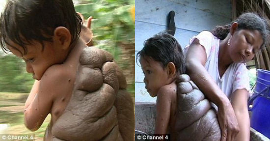 由于巨大的胎痣，蒙塔沃一家遭到本村村民的排斥