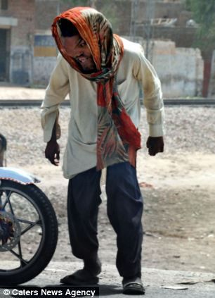 尽管身体畸形，穆塔兹仍对生活充满希望