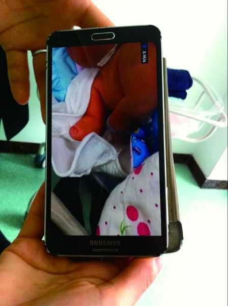 男婴产检正常出生却无右手 官方称产检不含手足