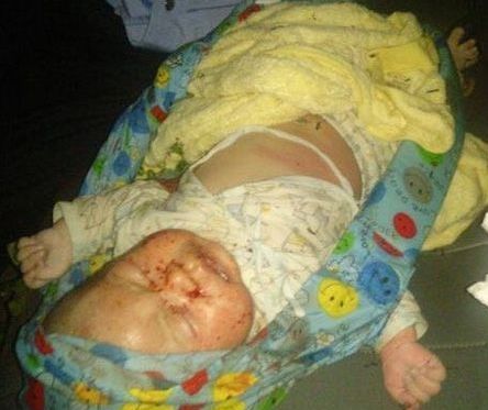 男婴被爸遗弃脸上爬满蚂蚁