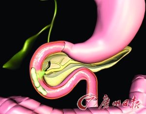 资料图片。(来源：广州日报)