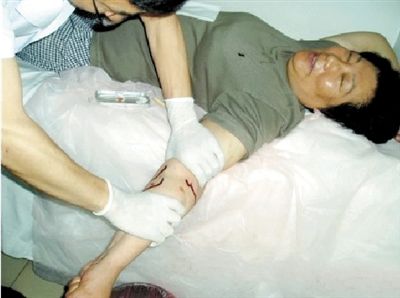 贾朝先微博上发布的放血现场图片。 